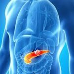 Панкреатит: причини та симптоми