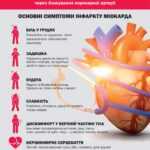 Інфаркт міокарда