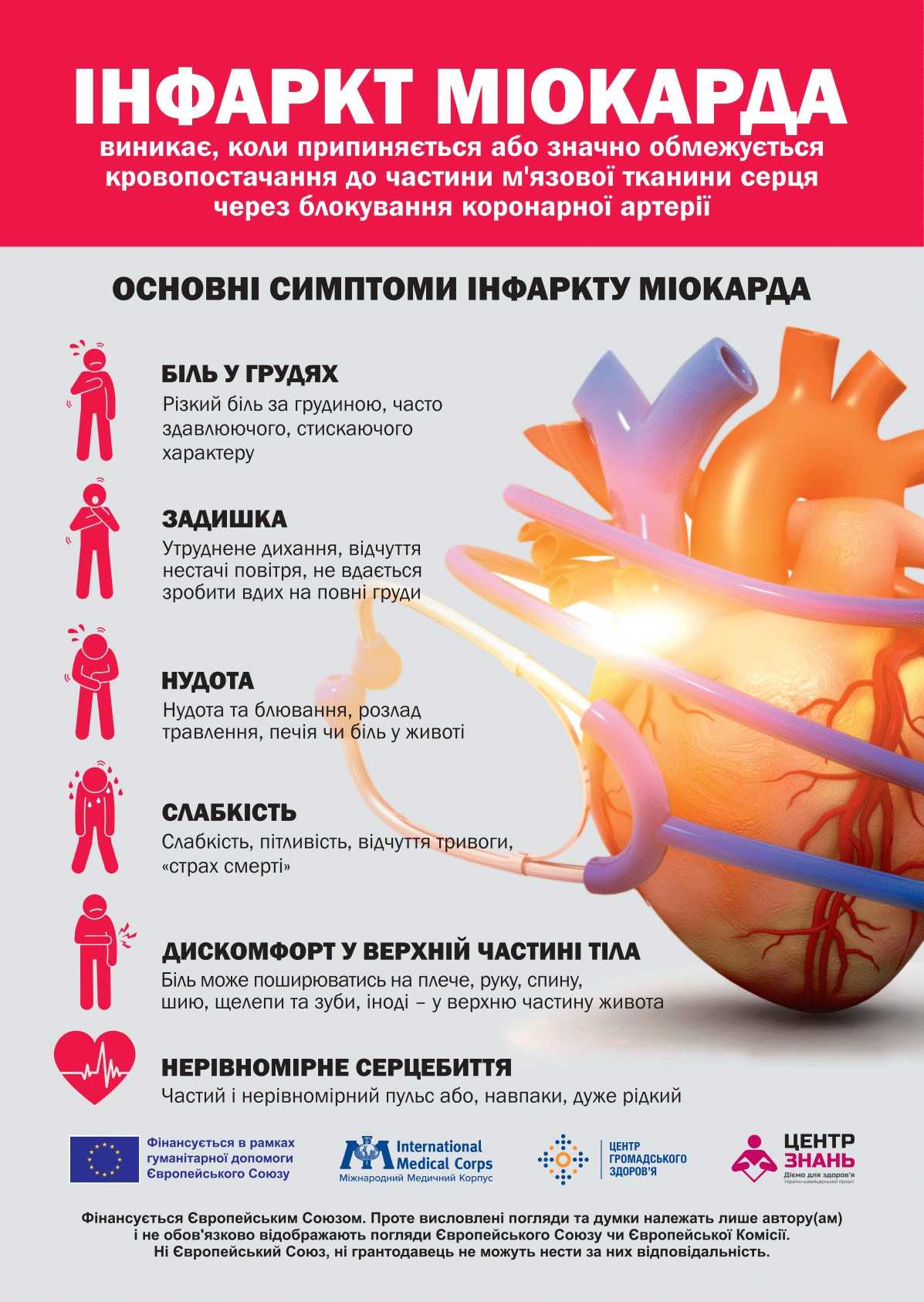 Інфаркт міокарда